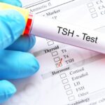 TSH test